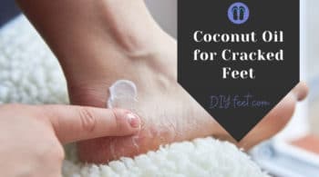 Coconut Oil for Cracked Feet with DIY Foot Soak