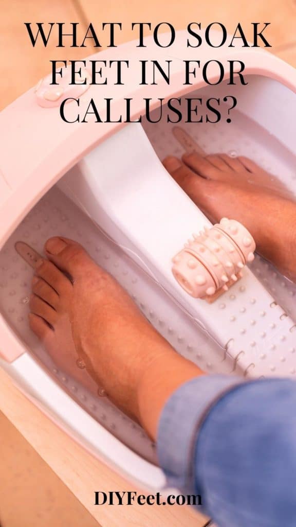 What to Soak Feet in for Calluses